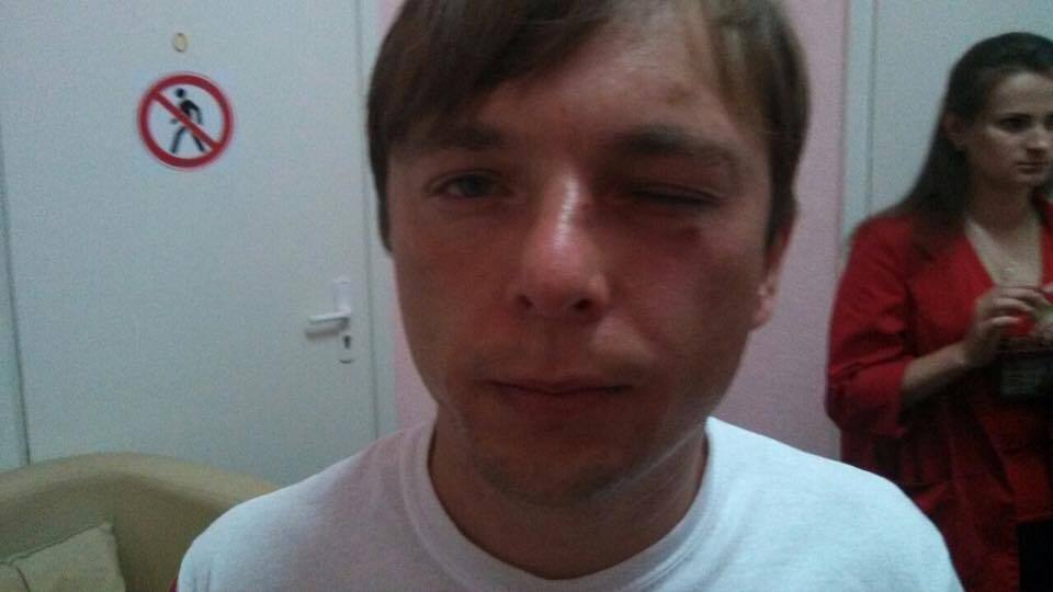 Поліція відкрила справу за фактом побиття журналіста Сергія Медяника