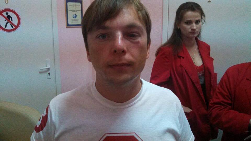 Поліція відкрила справу за фактом побиття журналіста Сергія Медяника