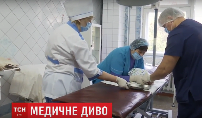 У Миколаєві малюкові, від якого через патологію відмовилися батьки, провели унікальну операцію