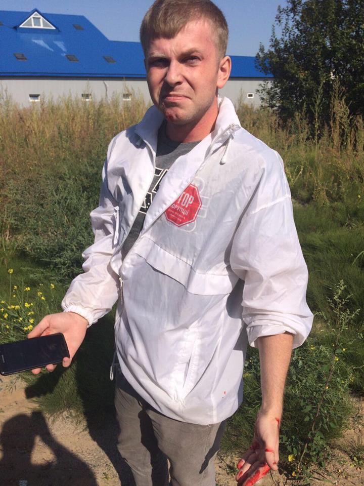 На активістів ''СтопКору'' напали невідомі під час мирної акції проти нелегальної забудови у Гатному на Київщині