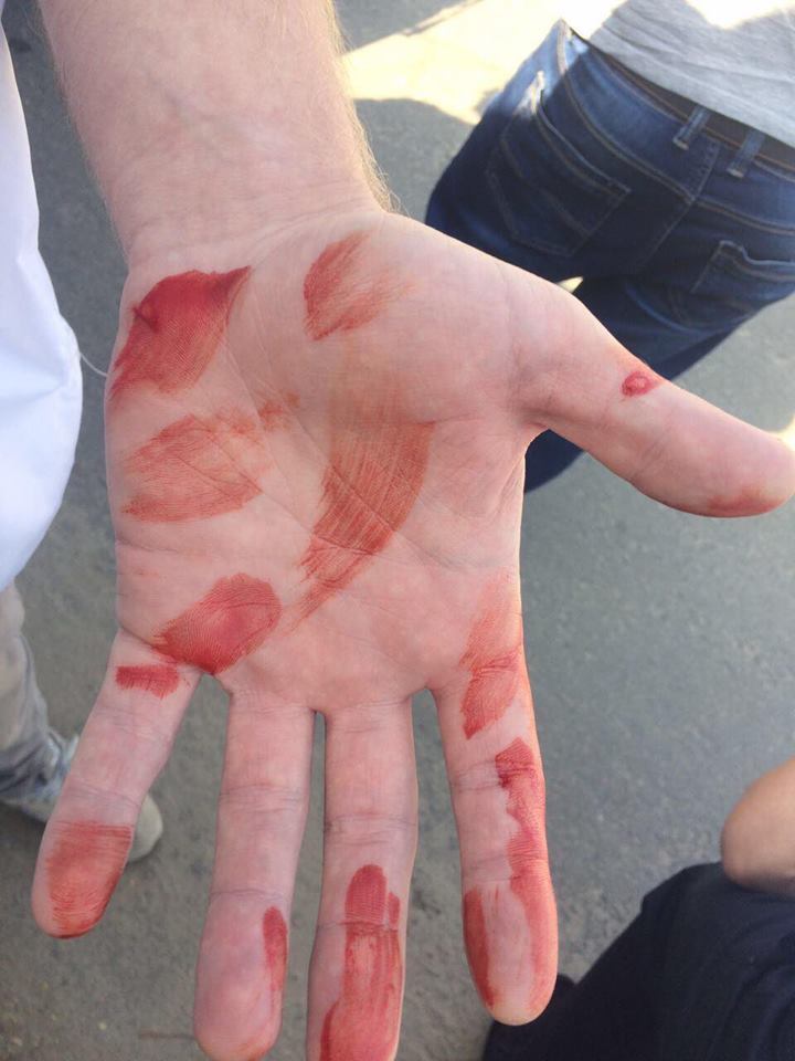 На активістів ''СтопКору'' напали невідомі під час мирної акції проти нелегальної забудови у Гатному на Київщині