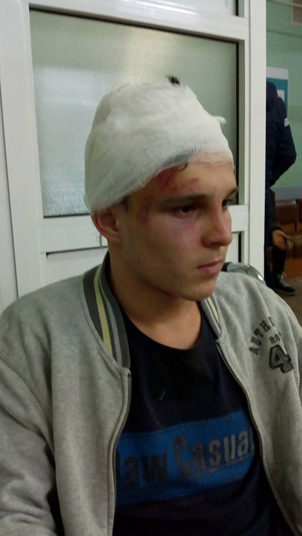 На Київщині група підлітків по-звірячому побила хлопця у новорічну ніч