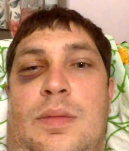 ''Спритність рук'' – слідчі зі Слов'янська загубили матеріали справи по нападу на активіста