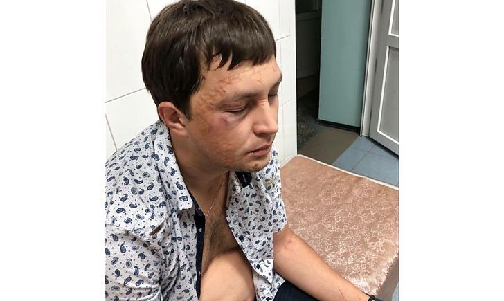 ''Спритність рук'' – слідчі зі Слов'янська загубили матеріали справи по нападу на активіста