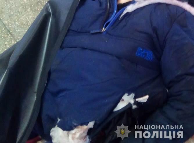 Поліція Вінничини розшукує родичів молодого чоловіка, який кинувся під потяг і загинув (ФОТО)