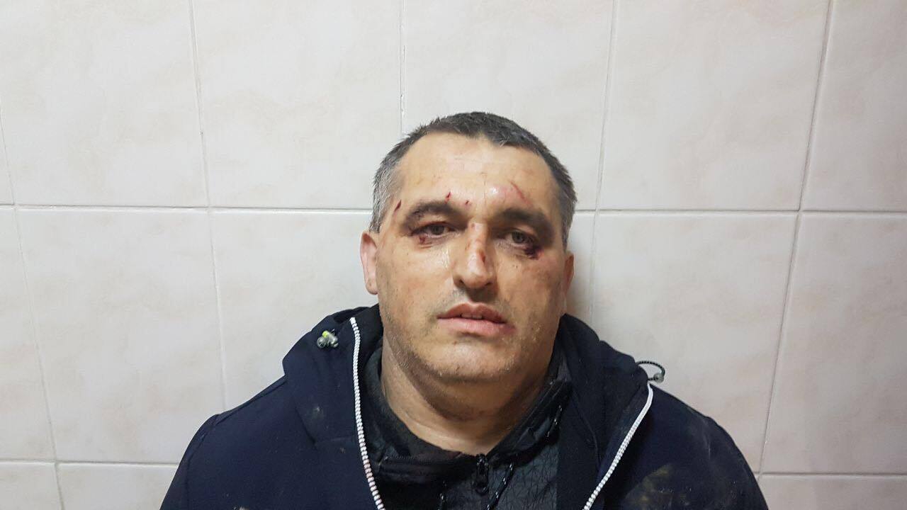 На активіста ''СтопКору'' з Чернівців напали невідомі