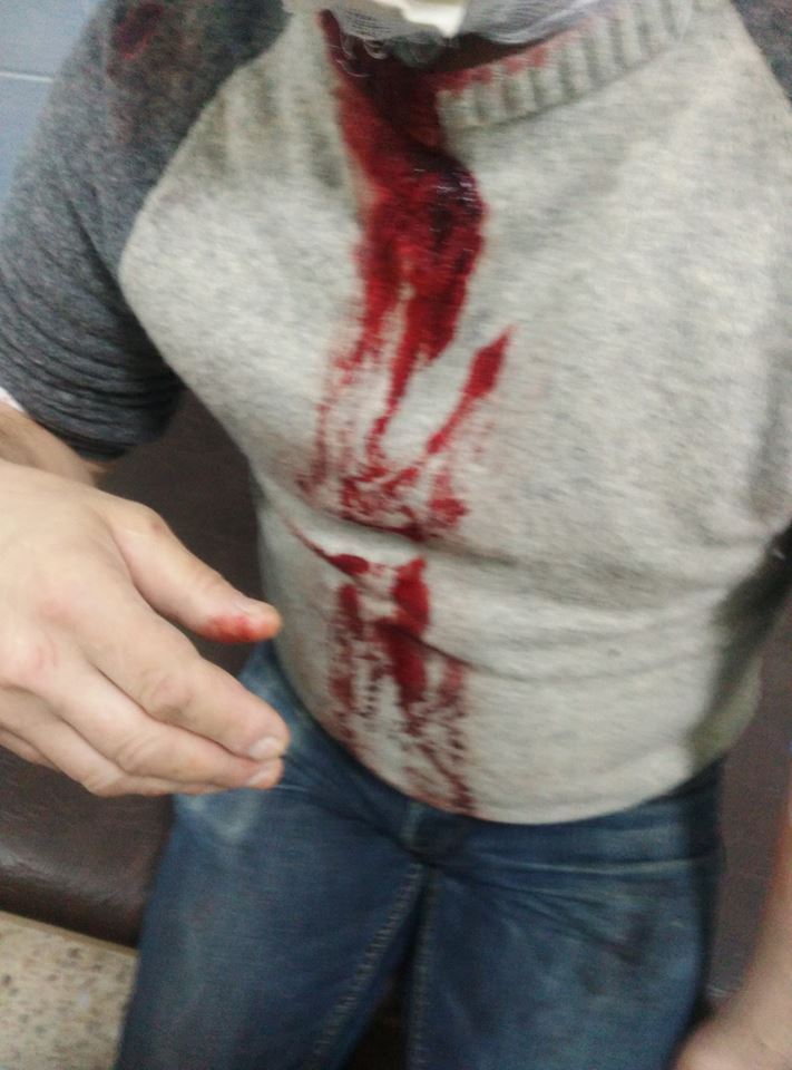 Біля одного зі столичних університетів перехожого поранили ножем в шию (ФОТО 18+)
