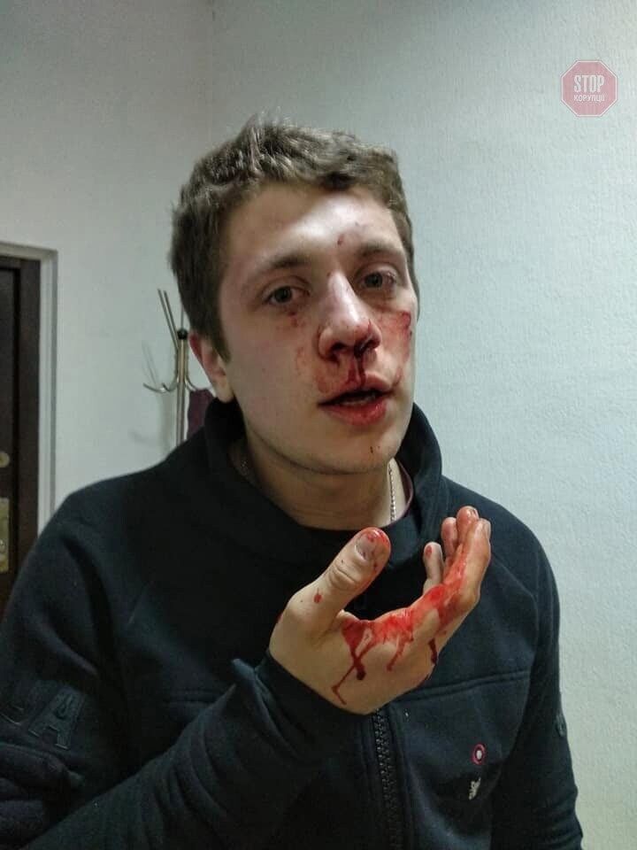 У Дніпрі невідомі в балаклавах побили активістів громадської організації (фото 18+)