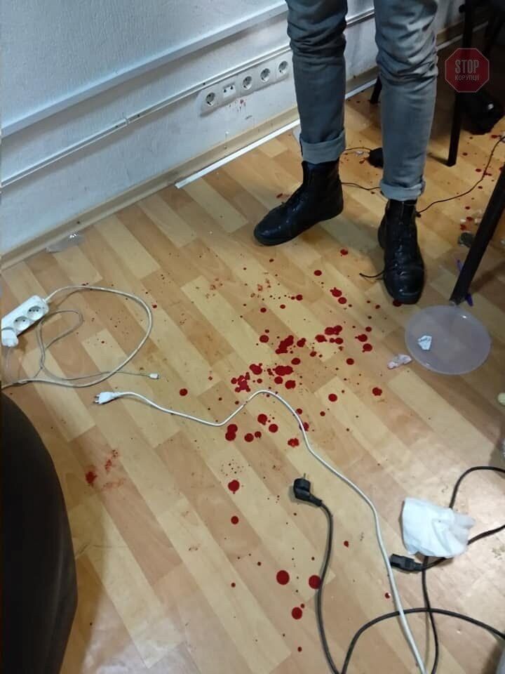 У Дніпрі невідомі в балаклавах побили активістів громадської організації (фото 18+)