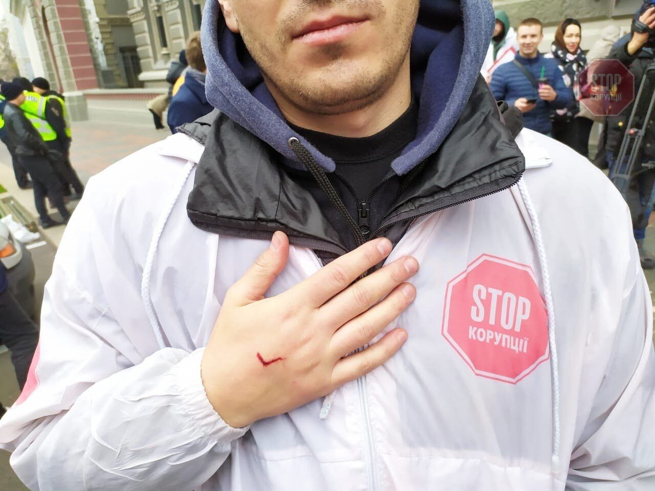  Активіста поранили, коли поліція намагалась демонтувати намет Фото: ''СтопКор''