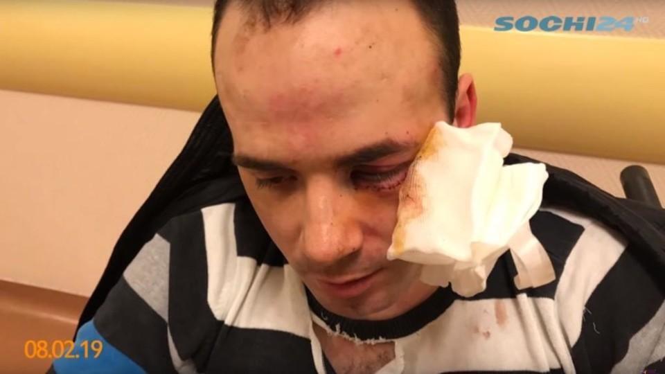 В Росії водій автомобіля сильно побив інваліда без ніг (ВІДЕО)