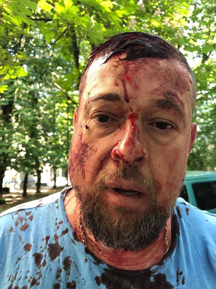 У Харкові сильно побили активіста Нацкорпусу (ФОТО)
