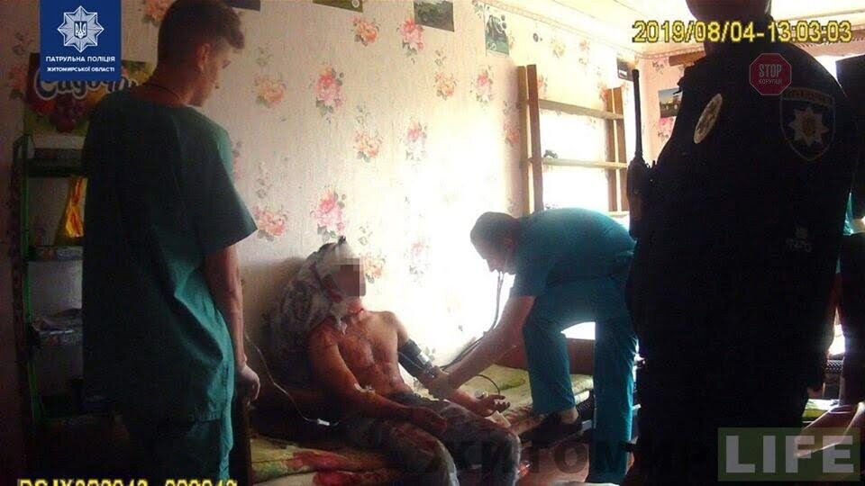 У Житомирі 18-річний юнак намагався покінчити життя самогубством (ФОТО)