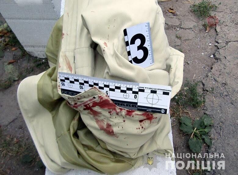 У Києві чоловік вистрілив у колишню дружину з гарпуна (фото)