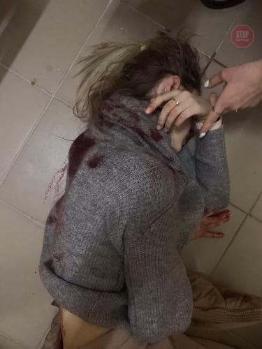 У Києві невідомий намагався зґвалтувати дівчину та порізав її ножем (фото 18+)