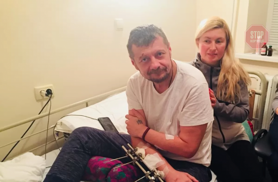 Відомий екснардеп залишається під охороною СБУ