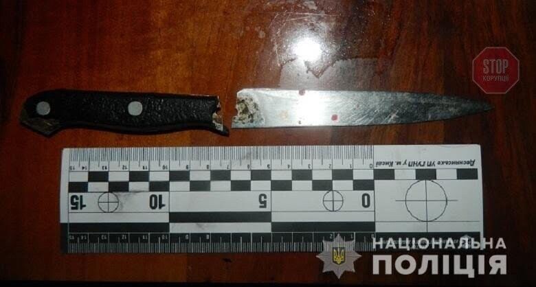 В столиці чоловік ошпарив маму окропом і отримав поранення в живіт від сестри (фото)