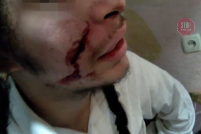 В Умані порізали 17-річного брацлавського хасида (фото, відео)