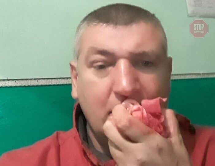  В Олевську на кандидата Ігнатьєва напали люди Пашинського Фото: СтопКор.