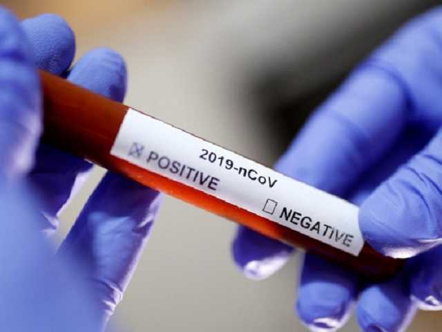 В Украине объявили о создании собственной тест-системы для определения коронавируса