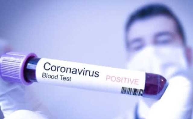 Смертельный коронавирус могут переносить домашние животные – ВОЗ