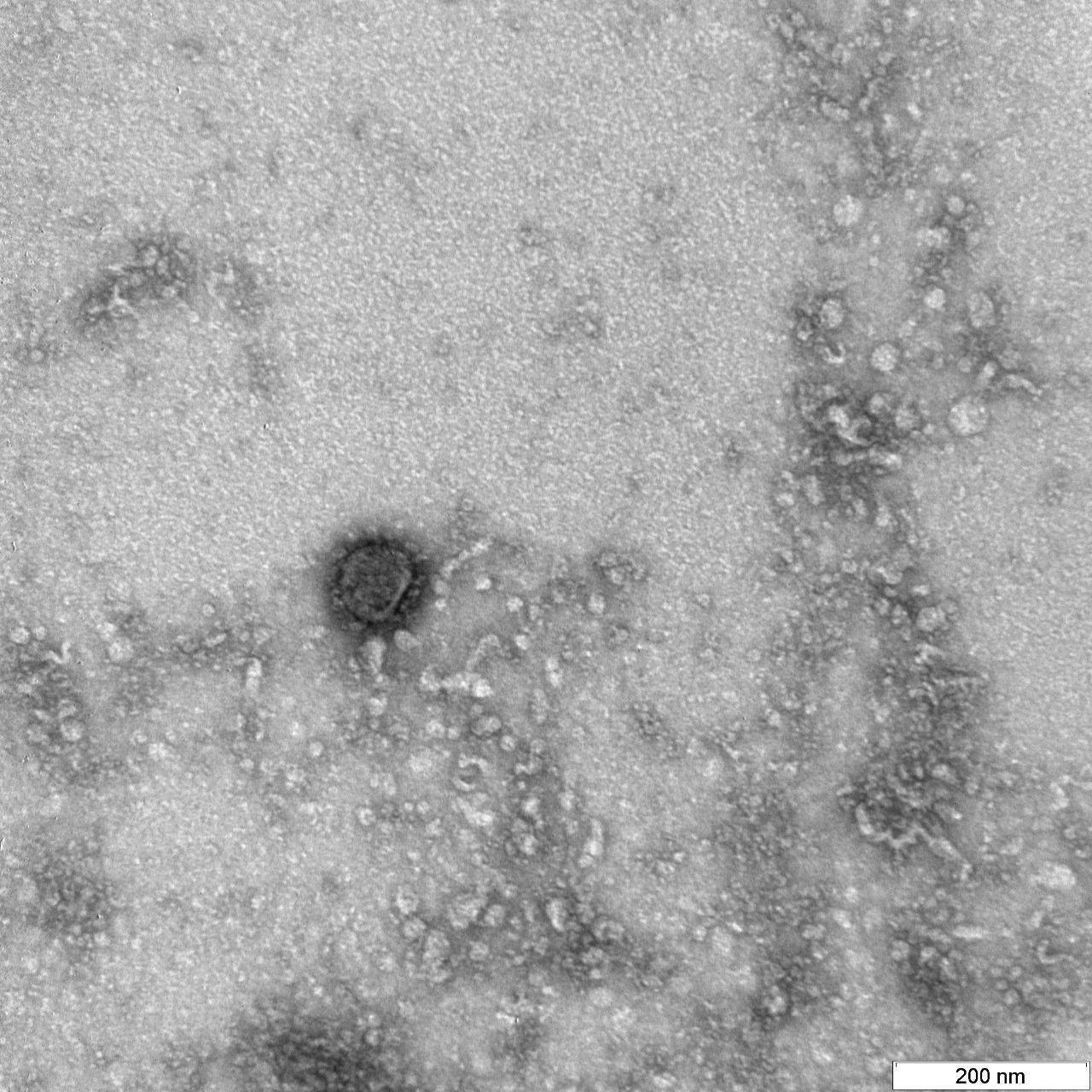 Как выглядит коронавирус COVID-19 под микроскопом: в сети появилось фото