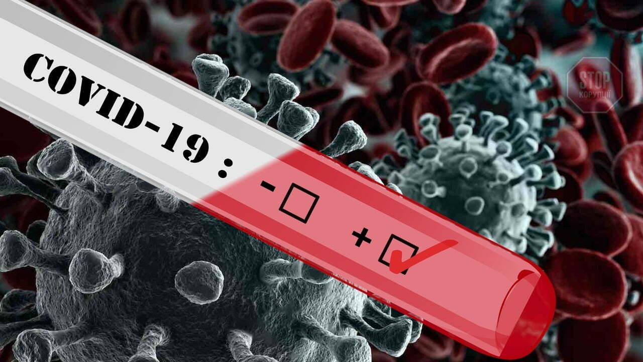 Журналісти з’ясували, хто гальмує розробку вітчизняних тест-систем на коронавірус