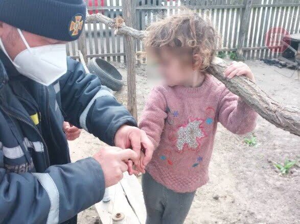 На Херсонщині 6-річна дівчинка наділа на палець шайбу і не змогла зняти (фото)