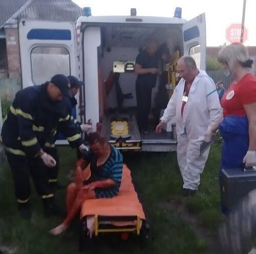 На Черкащині жінка впала у погріб: на допомогу вирушили рятувальники (фото)