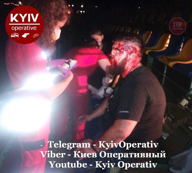 На Київщині сталася масова бійка зі стріляниною, є поранений (фото 18+)