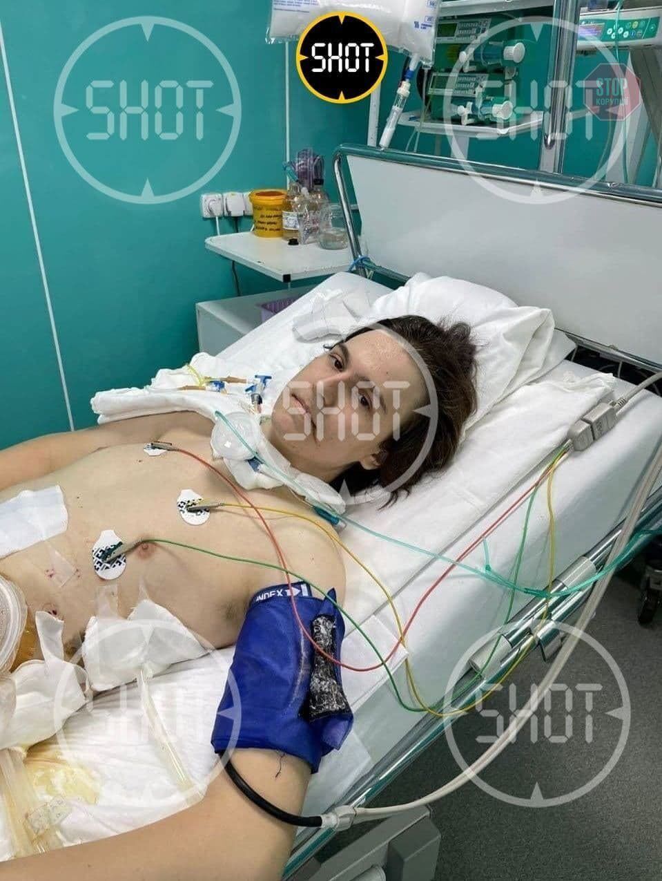  Тимур Бекмансуров пришел в сознание в реанимации Фото: Боруссия Дортмунд