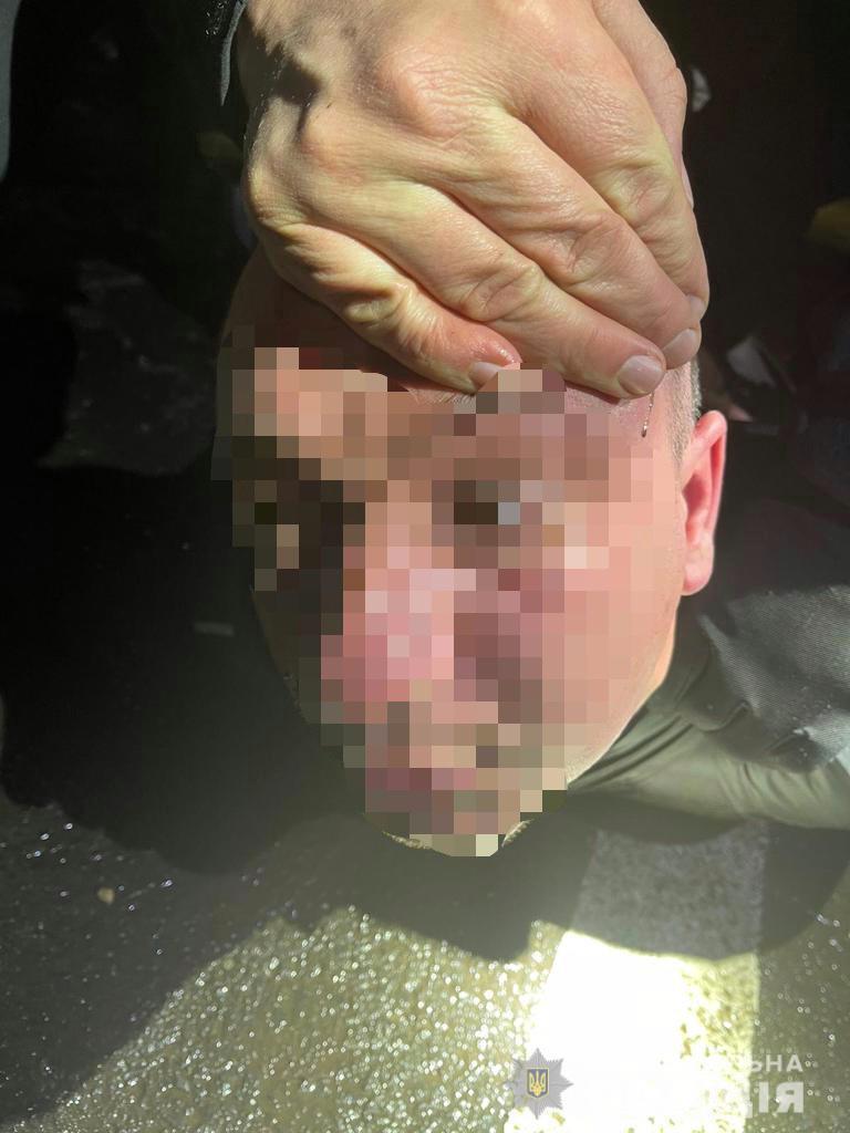 На Закарпатті правоохоронці затримали групу зловмисників за розбійний напад