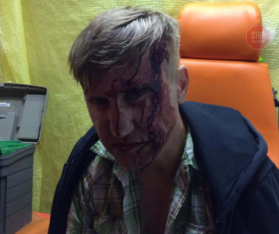  У Коростені побили депутата міськради. Фото: соціальні мережі