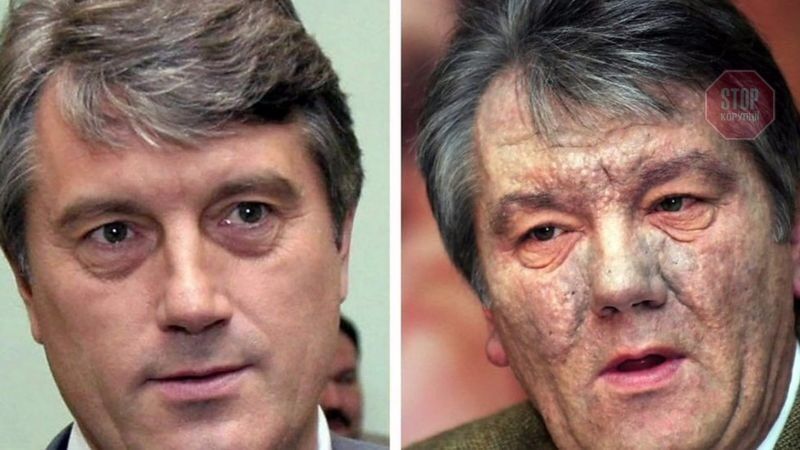  Віктор Ющенко до та після отруєння Фото: Other