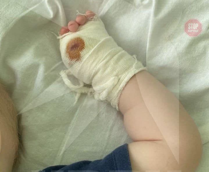 Тигр откусил палец малышу в Крыму (фото)
