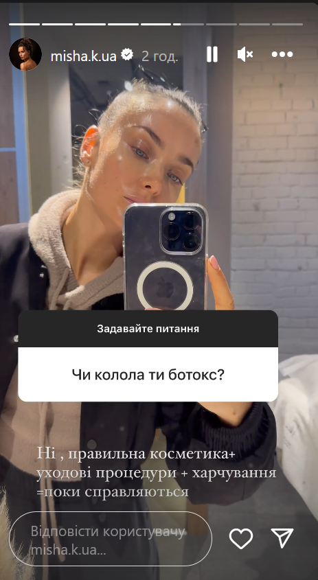 Актриса Ксения Мишина призналась, делает ли инъекции ботокса