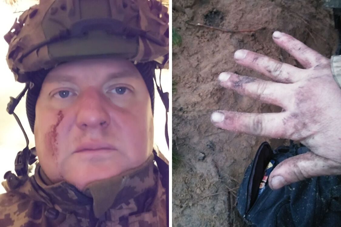 Владимир Чеславский получил ранения на Купянском направлении