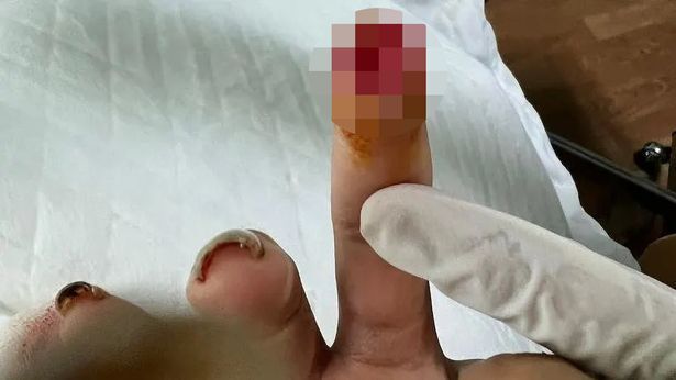В Таиланде россиянка откусила палец женщине из Британии и избила ее собаку (фото)