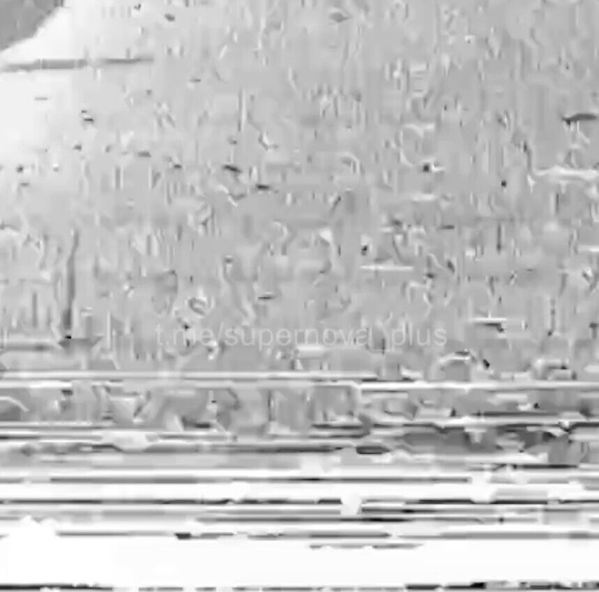 Дрон ЗСУ вибухнув в руках солдата армії рф: відірвано кисті, пошматовано обличчя (відео)