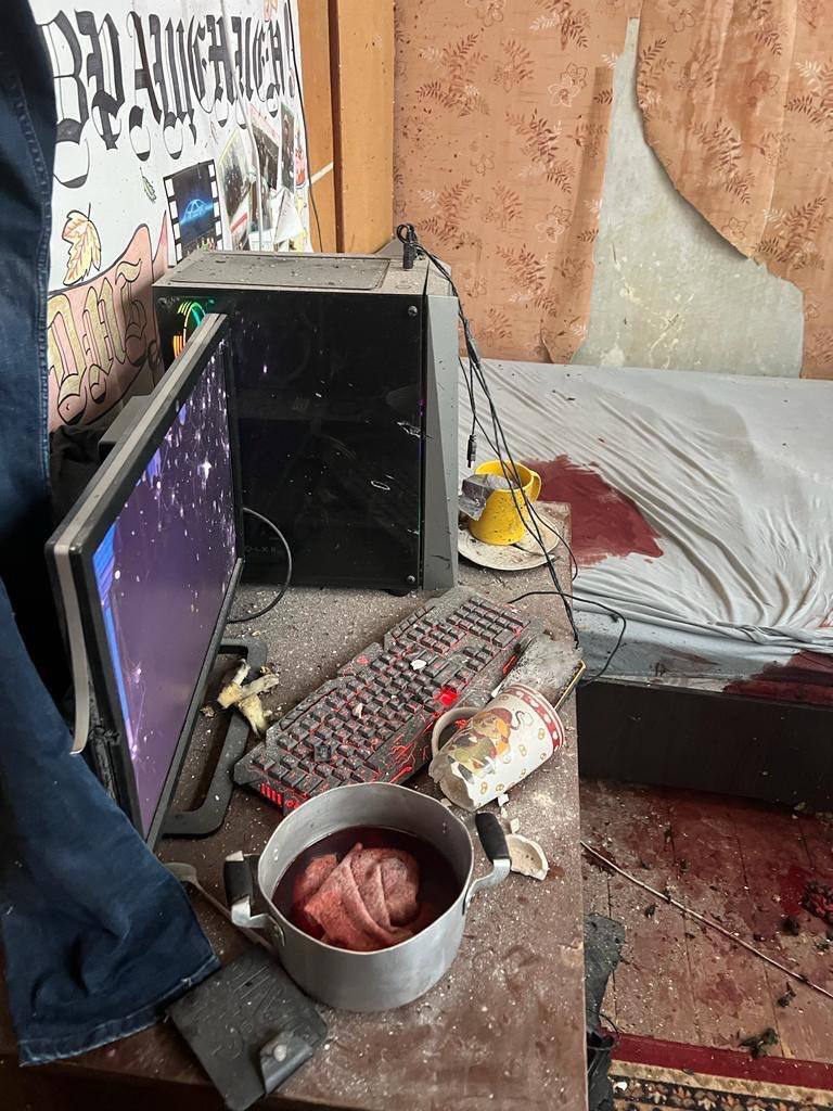Взрыв гранаты в Киевской области: 21-летний парень травмировал руку - Небитов