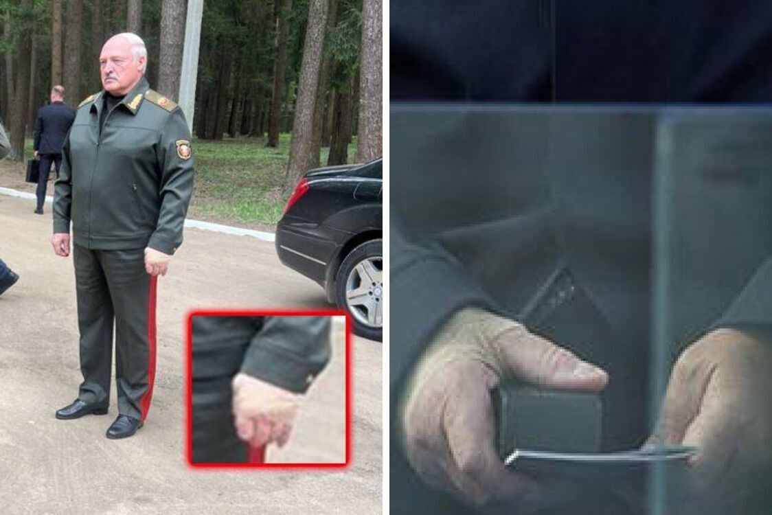 Бинт на руці Лукашенка