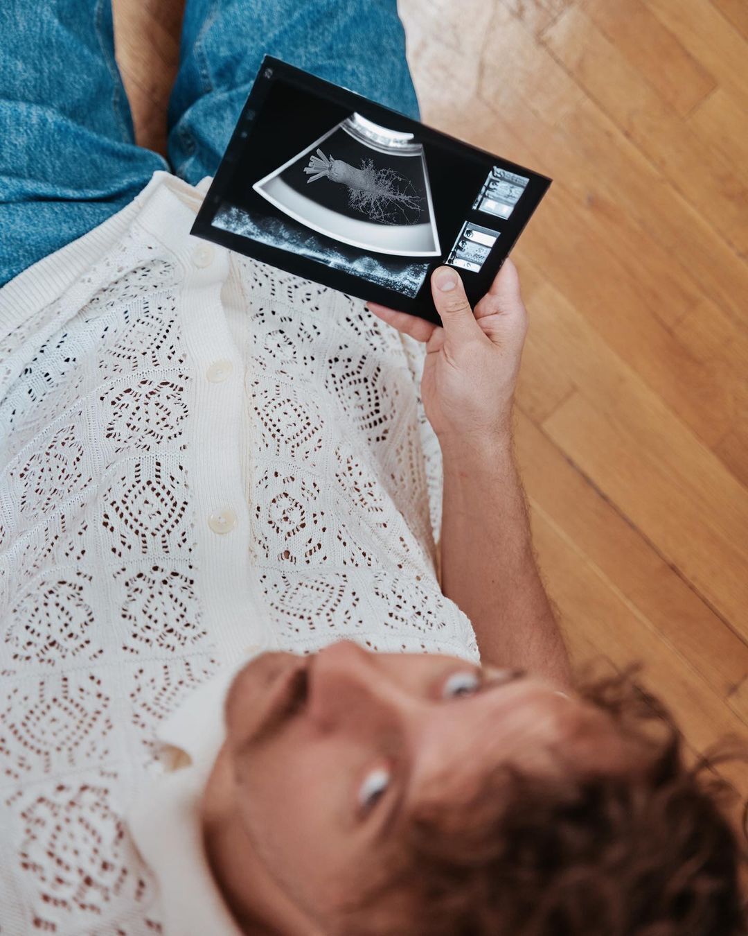 Клопотенко и снимок УЗИ