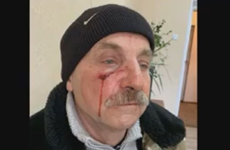 Игорь Кириллов после избиения
