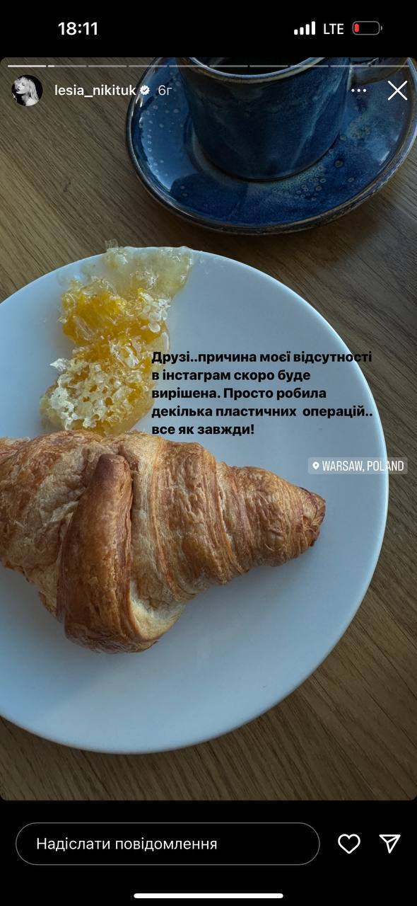 Делала несколько пластических операций: Леся Никитюк призналась, почему исчезла из Instagram