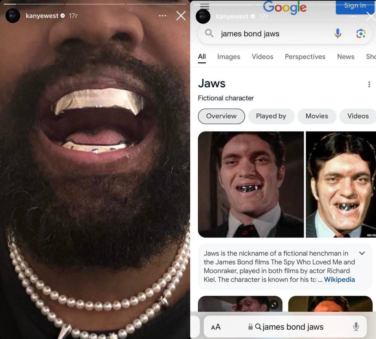 Каньє Вест позбувся своїх зубів за 850 тисяч доларів: як тепер виглядає репер