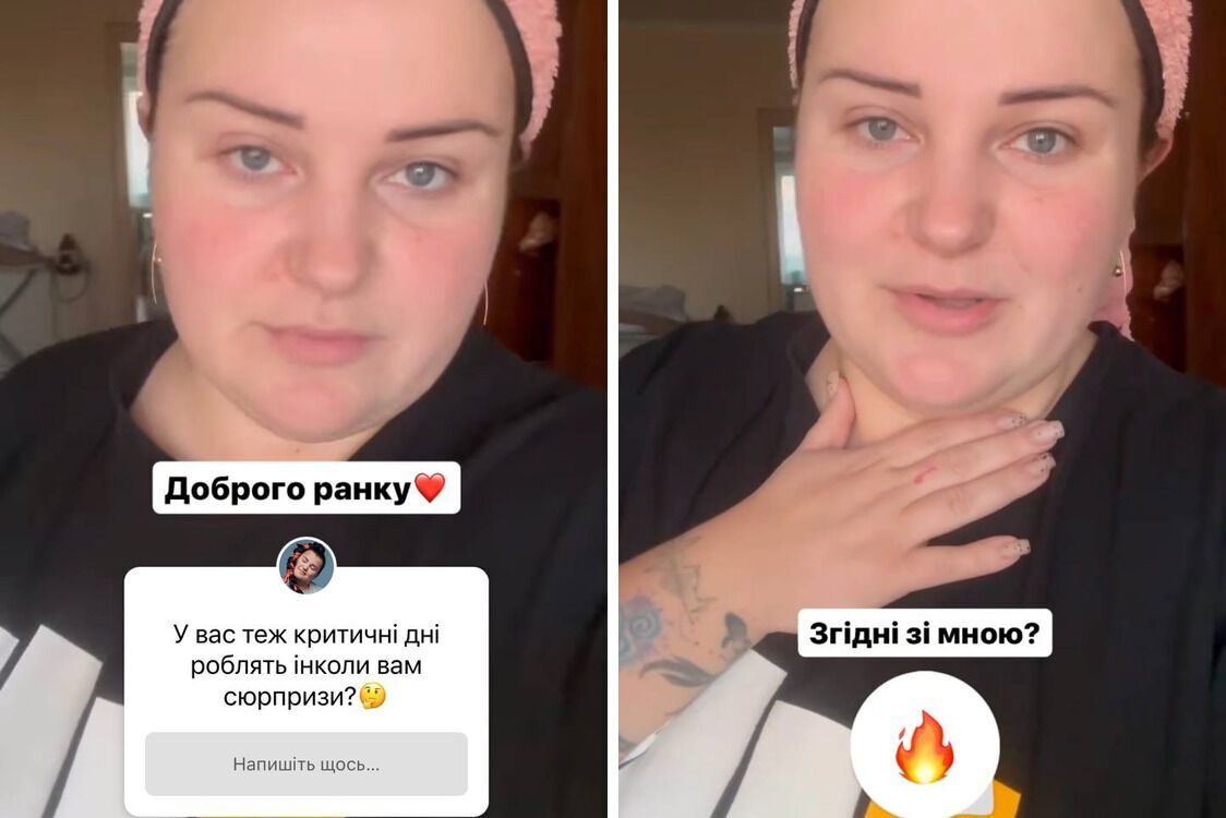 Альона Альона сторіс