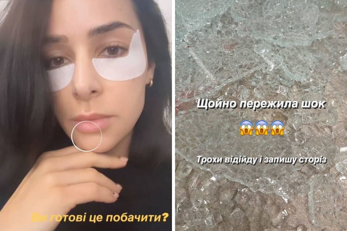 Пережила шок: на Огнєвіч впали скляні двері
