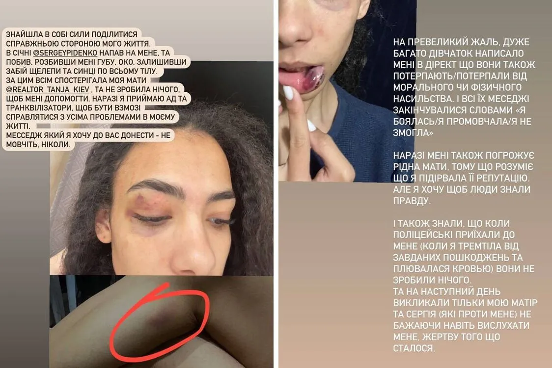 Сториз Емілі Москаленко