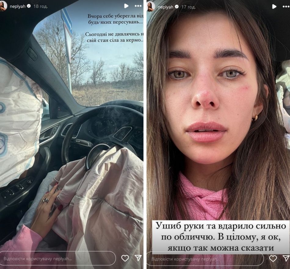 Мисс Украина Вселенная Анна Неплях попала в серьезную аварию по дороге в Днепр
