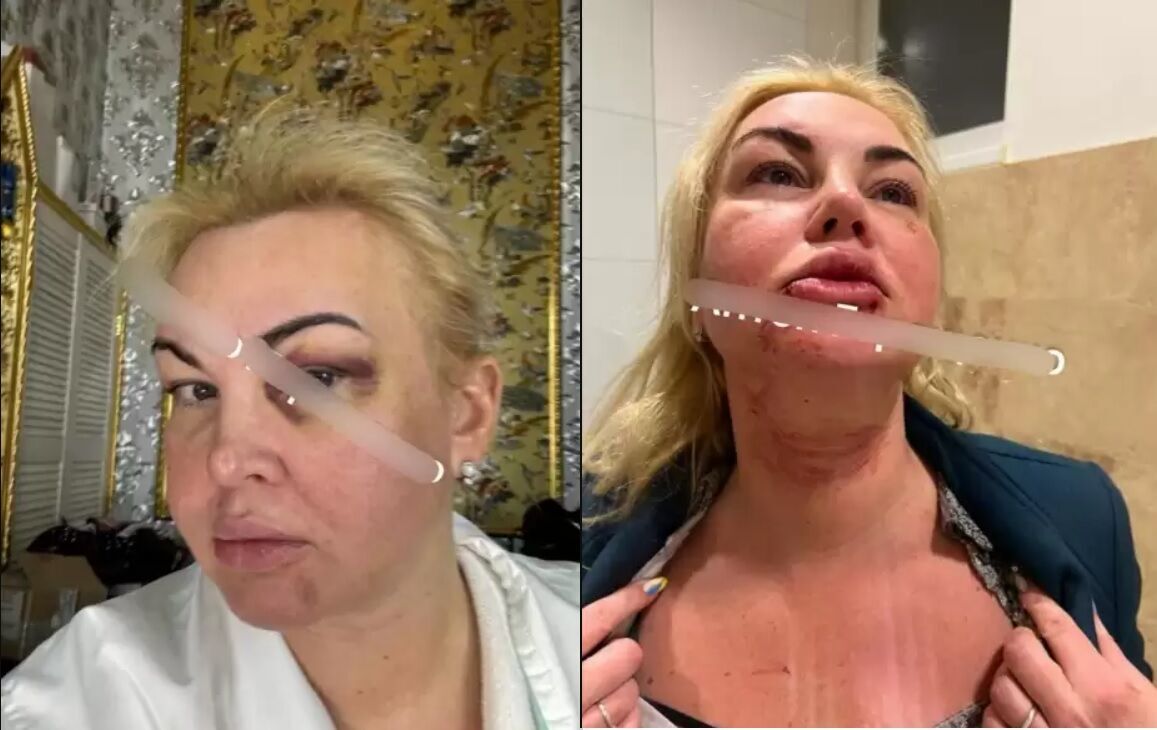 ''Зі мною, все добре'': Камалія спростувала чутки про побиття